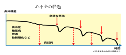 心不全の経過